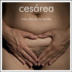CESÁREA: MAS ALLÁ DE LA HERIDA | 9788493752637 | ALVAREZ-ERRECALDE, ANA | Llibreria La Puça | Llibreria online d'Arsèguel - Comprar llibres en català online - Llibres Andorra i Pirineu